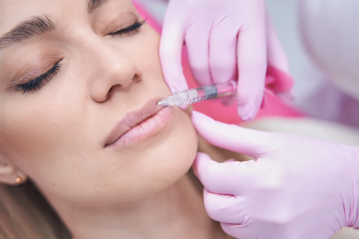 Lip Filler Service being performed in Ottawa